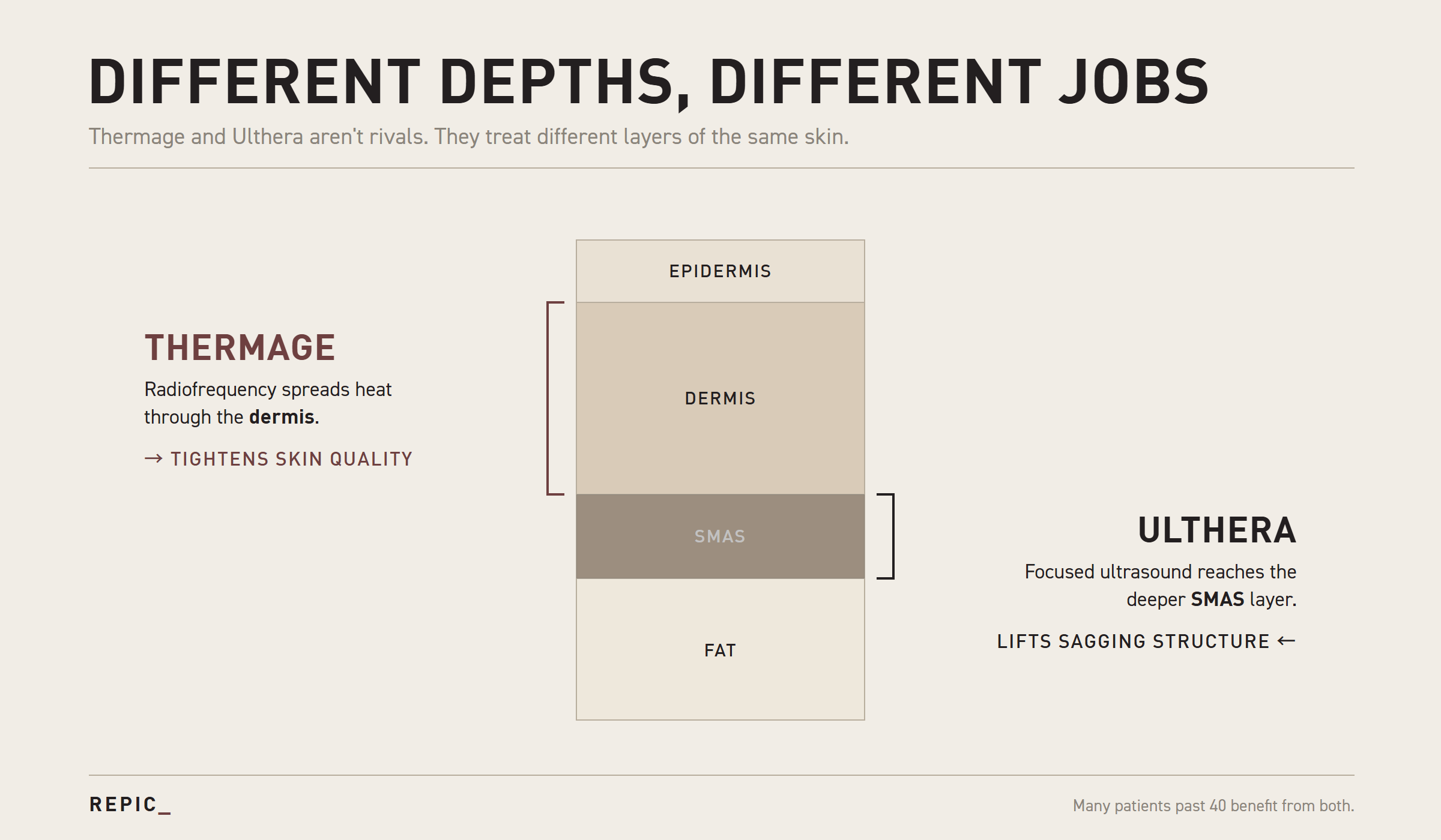 Thermage vs Ulthera depth comparison diagram